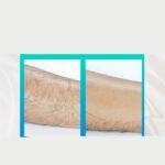 epilator nano glass hair removal tool 7